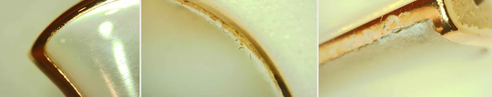 Microscope comparison of the join between mother-of-pearl and metal rim: smooth on the genuine piece at left, with a visible gap and hardened glue on the examined piece in the middle and right